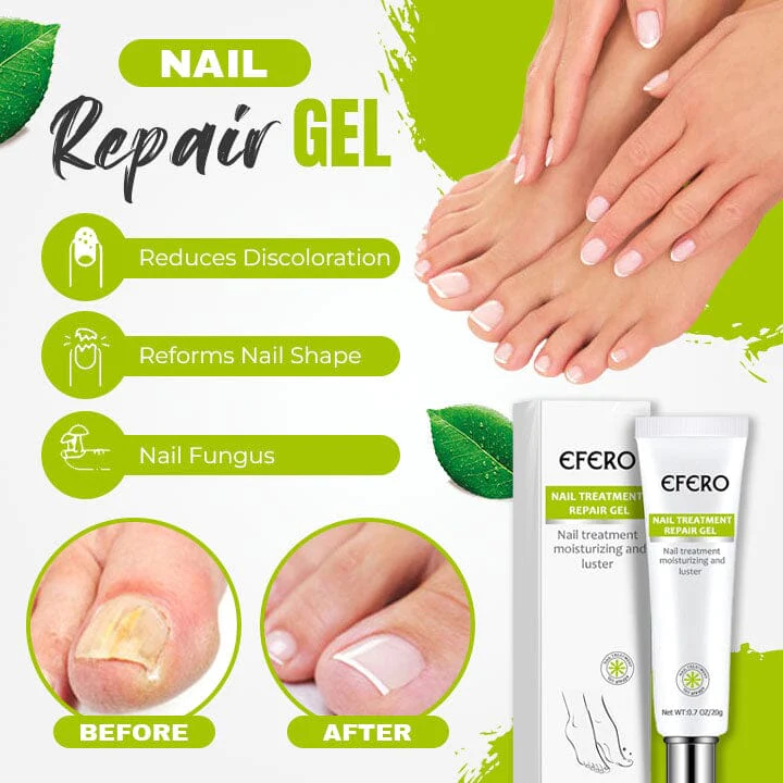 NailFast Nail 7 Days Treatment Gel