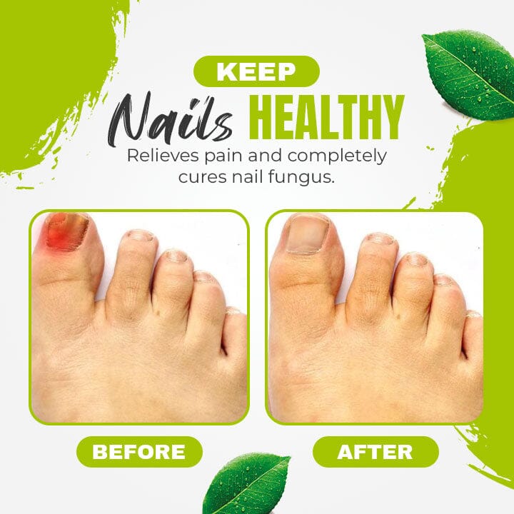 NailFast Nail 7 Days Treatment Gel