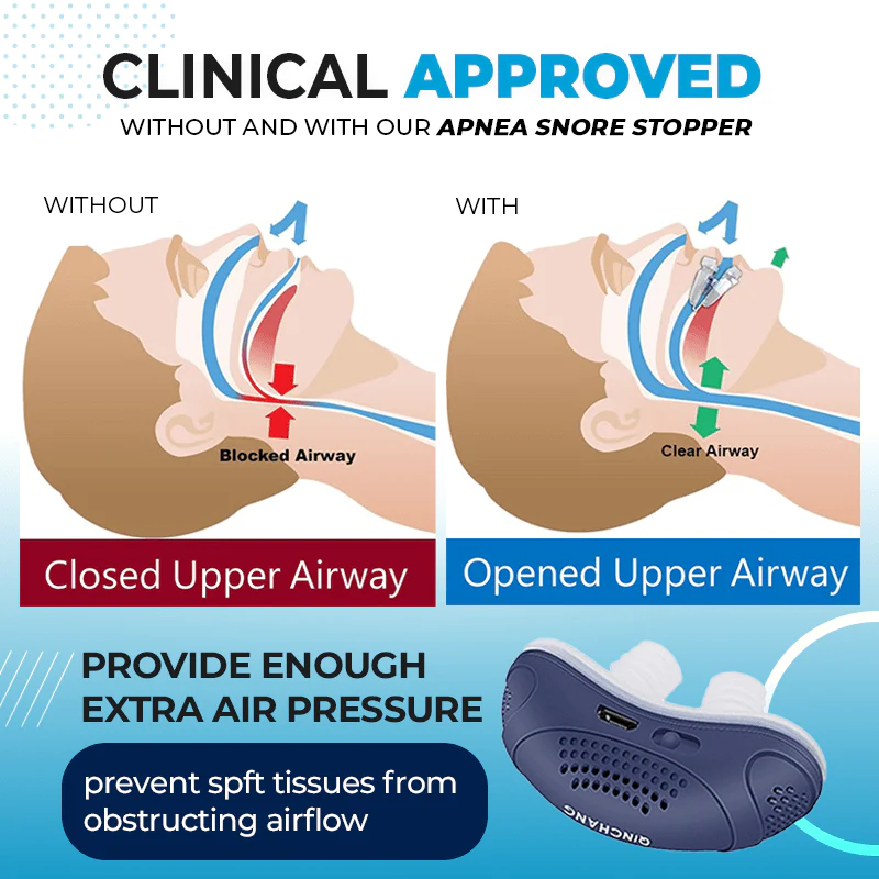 Electric Well Sleep Apnea Snore Stopper