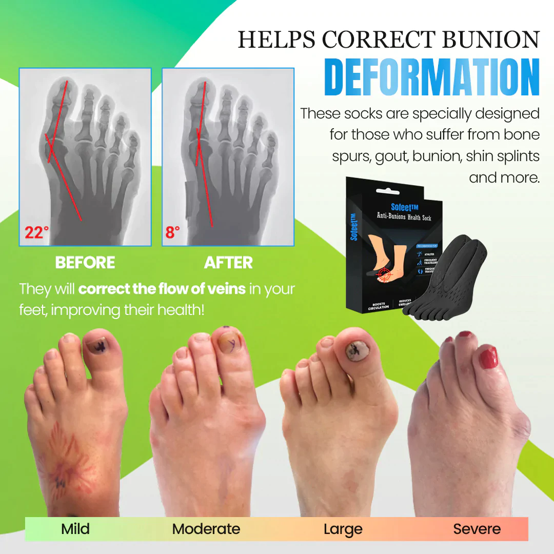 Sofeet Bunion Cure Health Sock