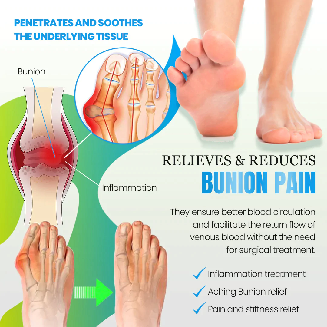 Sofeet Bunion Cure Health Sock