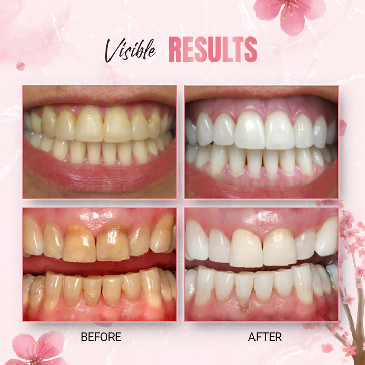 WhiteLab Teeth Stain Removal Whitening Strips