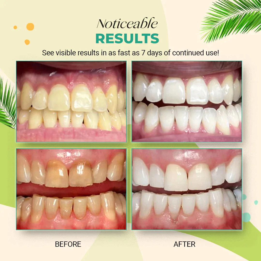 Coconut Oil Teeth Whitening Strips