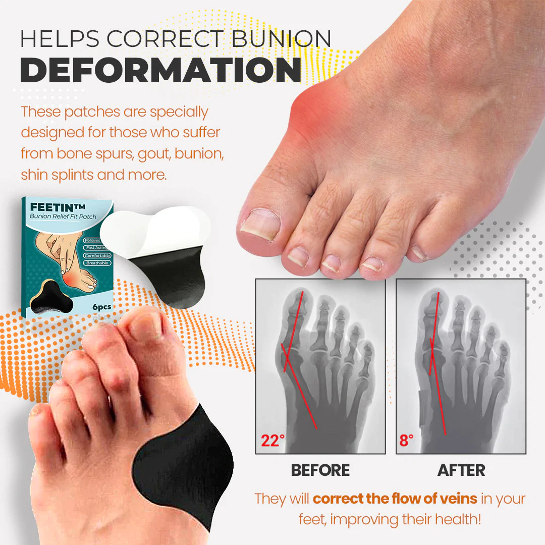 Feetin Bunion Relief Fit Patch