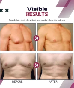 ChestX Gynecomastia Reduction Spray