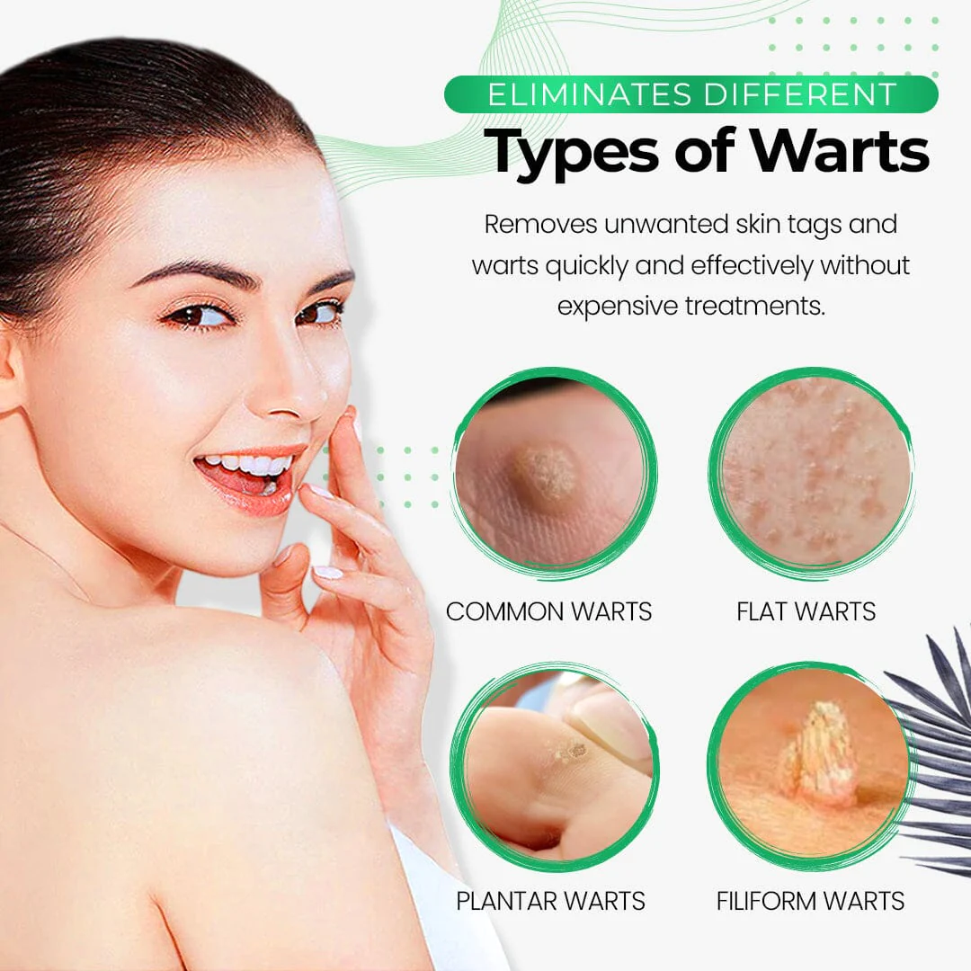 SmoothSkin Wart Eliminator Soap