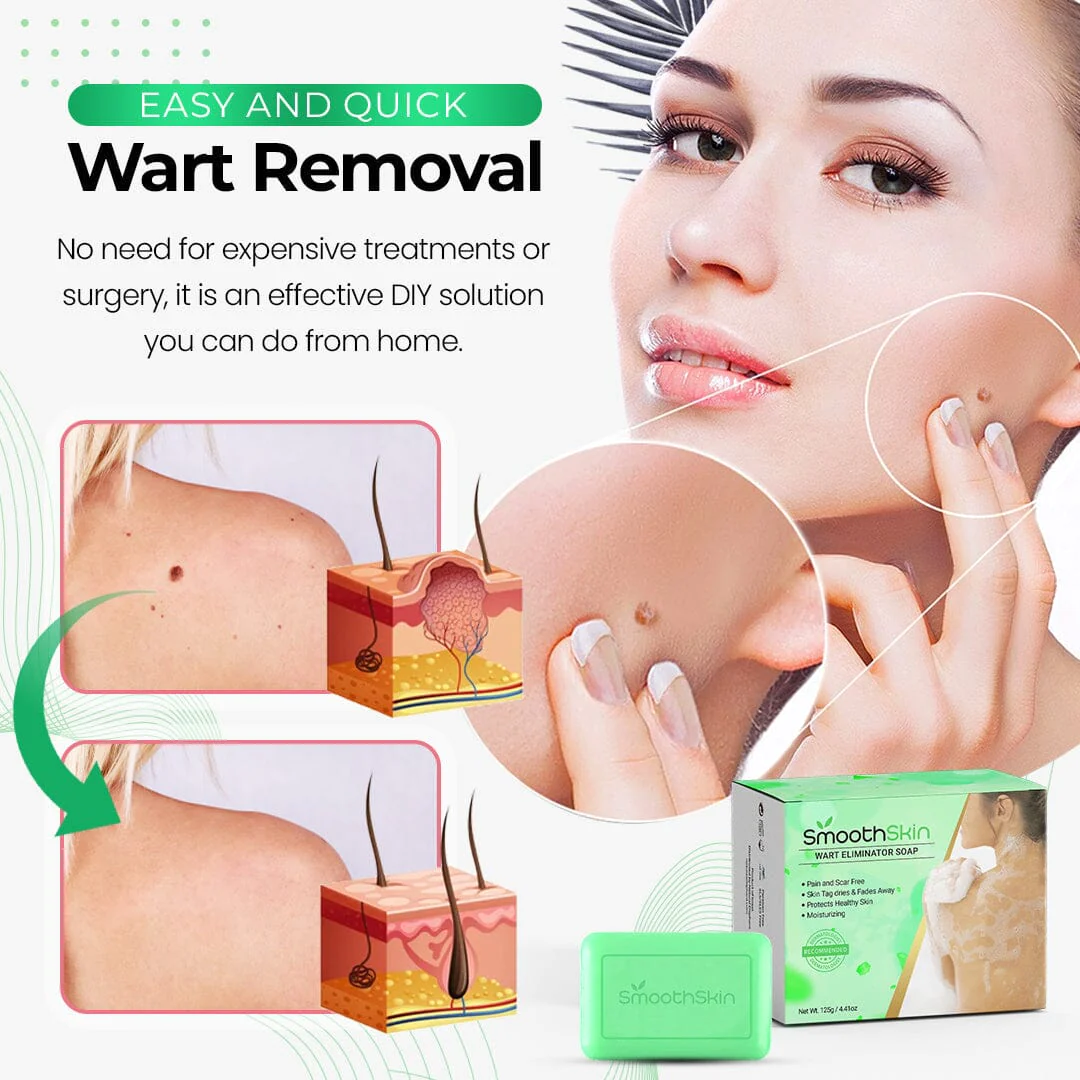 SmoothSkin Wart Eliminator Soap