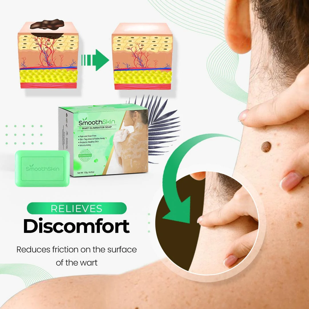 SmoothSkin Wart Eliminator Soap