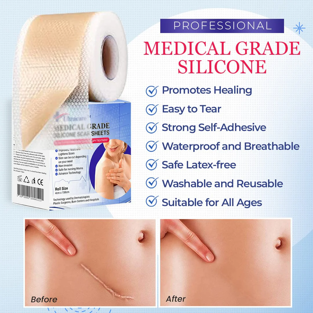 UltracareMedical Grade Silicone Scar Sheets