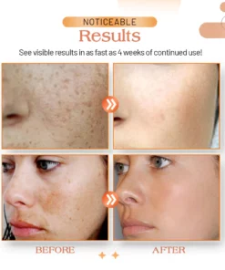 Vivid Melanin Removal Skin Balance Serum