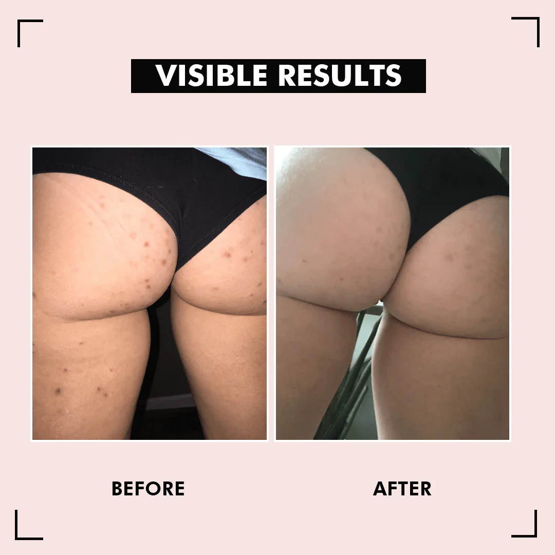 HipShine Perfect Butt Mask