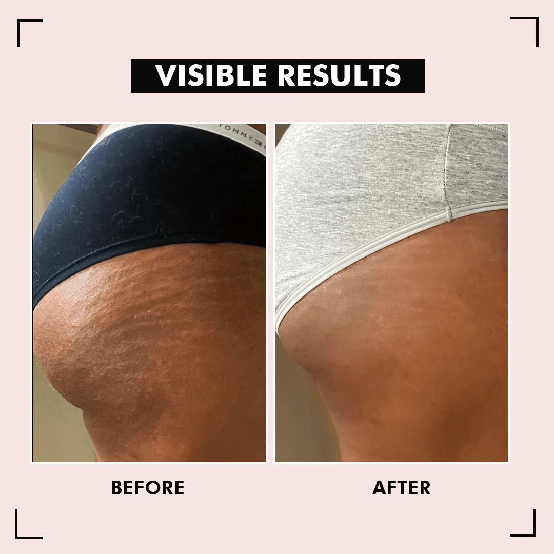 HipShine Perfect Butt Mask