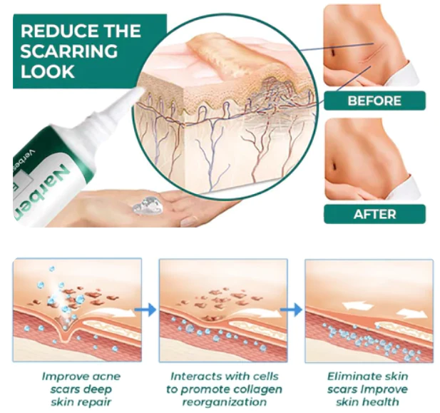 Furzero Advanced Medical-Grade Scar Gel With Stem Cells