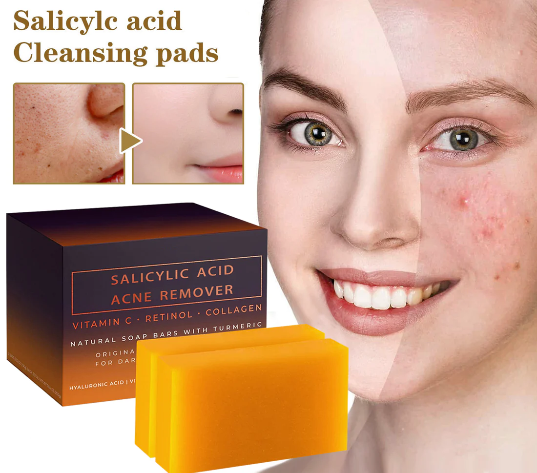 2023 NEW Warebrill Salicylic Acid Acne Remover