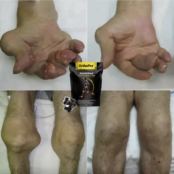 OrthoPro Joint & Bone Therapeutic Soak