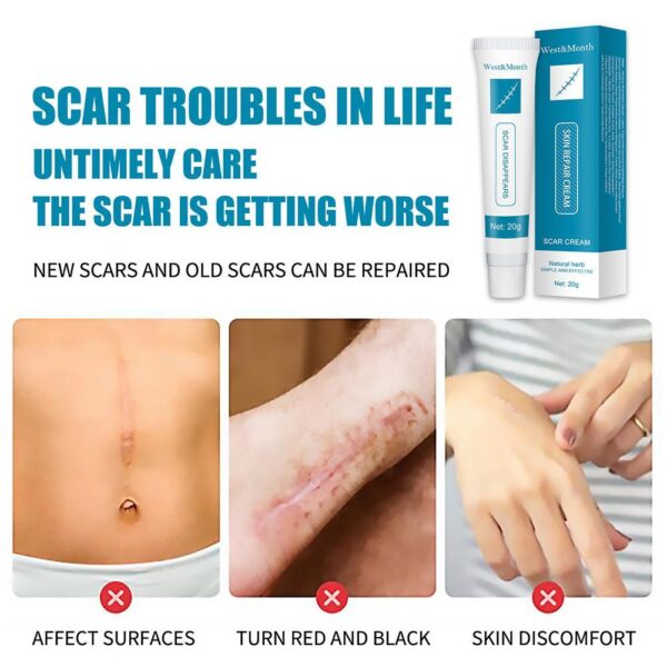 Scar & Acne Bump Removal Cream