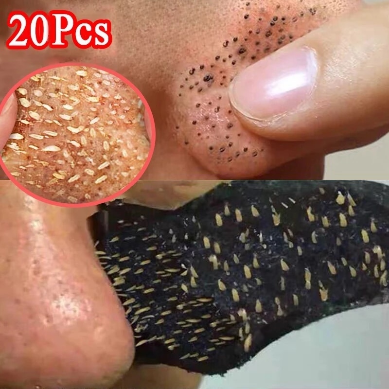 Blackhead Remover Nose Mask Acne Treatment