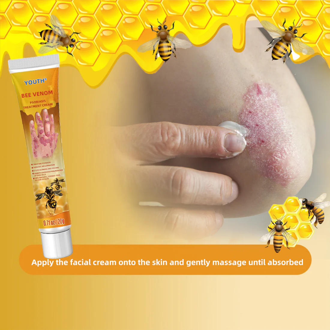 YouthŽ Bee Venom Psoriasis Treatment Cream