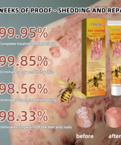 YouthŽ Bee Venom Psoriasis Treatment Cream