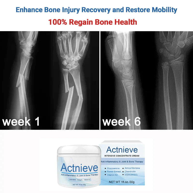 Actnieve Anti-Inflammatory & Joint & Bone Therapy Cream