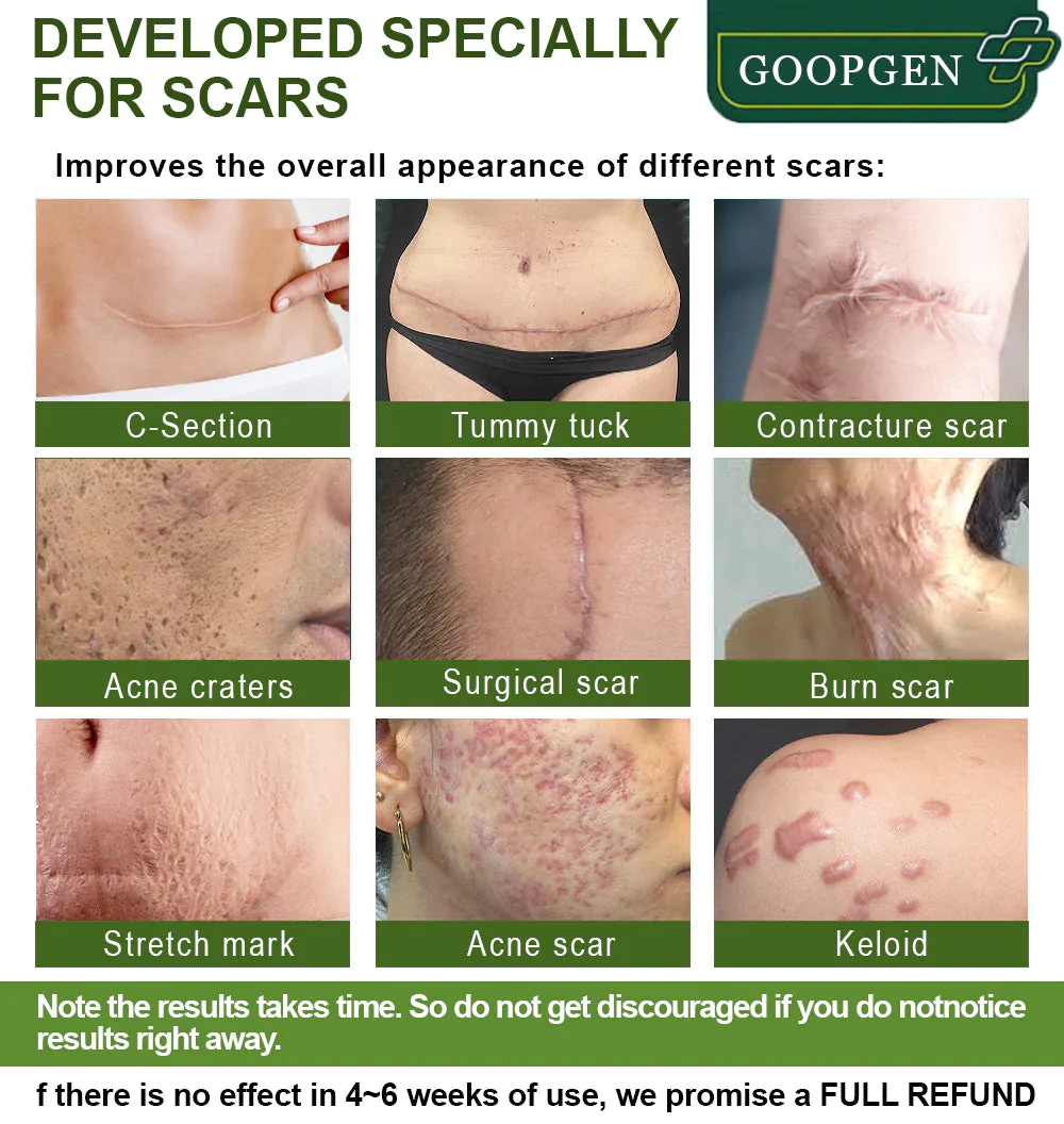 GOOPGEN Advanced Scar Repair Serum For All Types of Scars  Especially Acne Scars, Surgical Scars and Stretch Marks