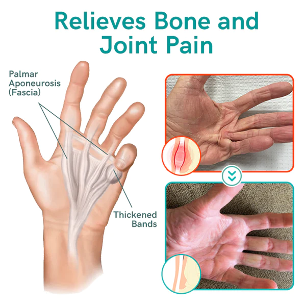 GFOUK Collagenase and Bone Therapy Cream