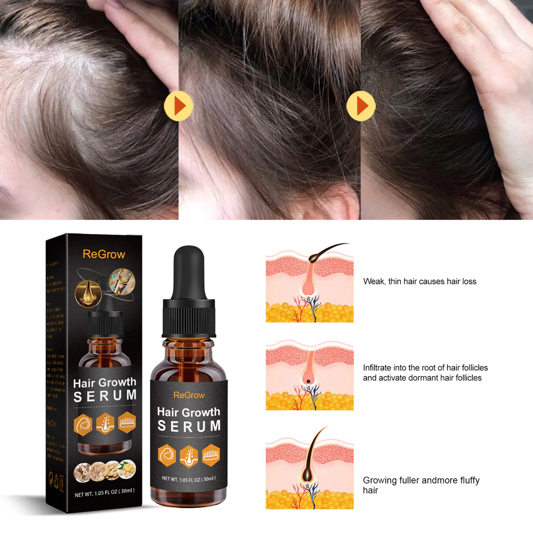 ReGrow VitaStrands Hair Growth Serum