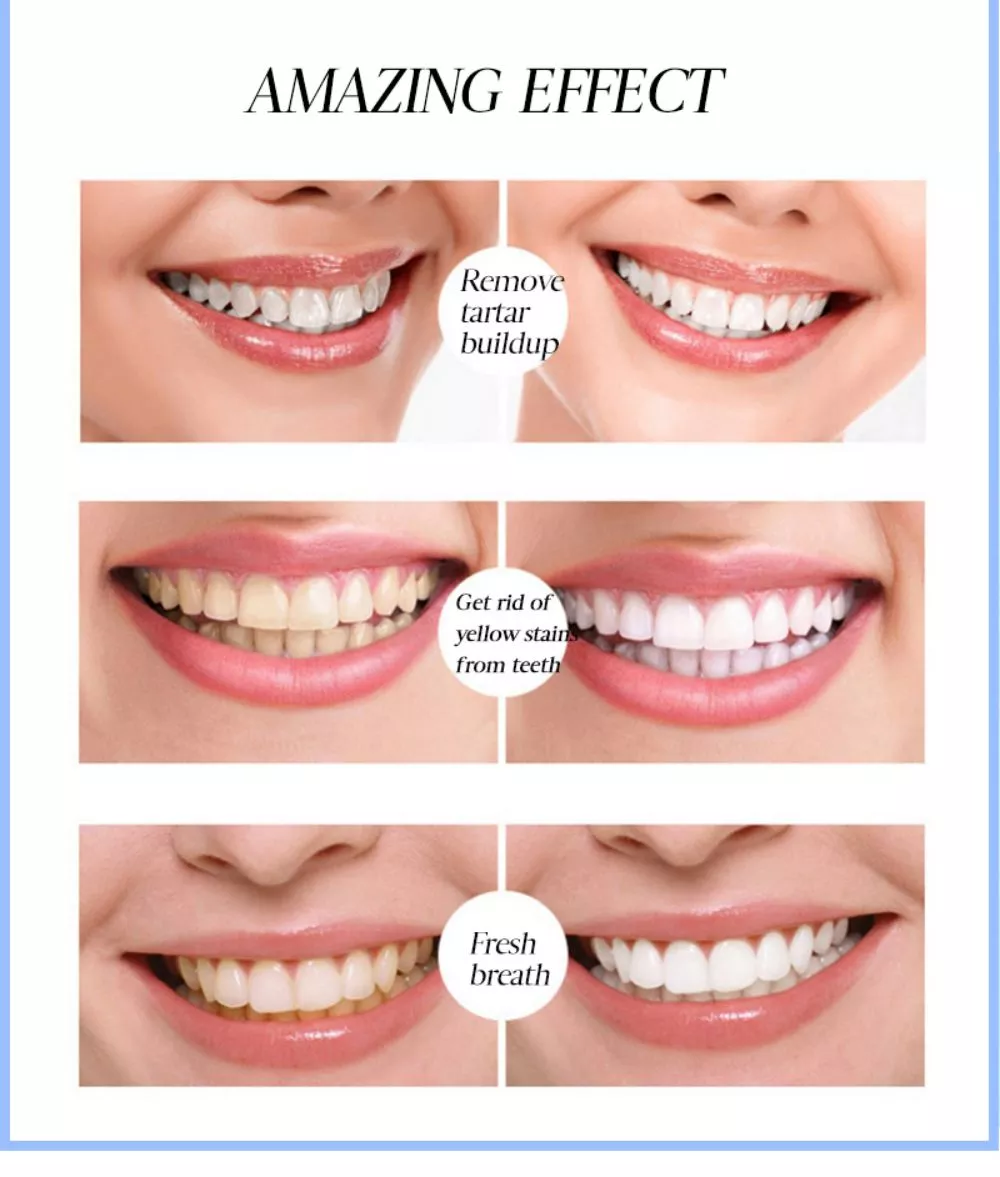 LAFEIGE Teeth Whitening Tooth Essence