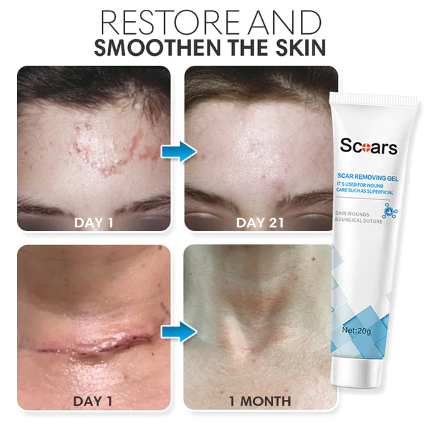 SmoothCare Organic Scar Remedy Gel