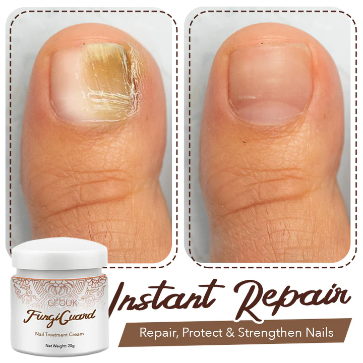 GFOUK FungiGuard Nail Treatment Cream