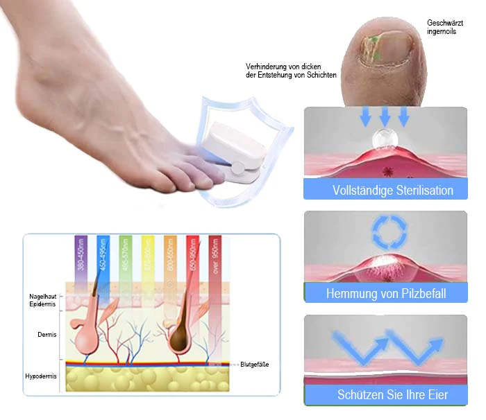 Ceoerty Antifungal Light Therapy Toenail Device