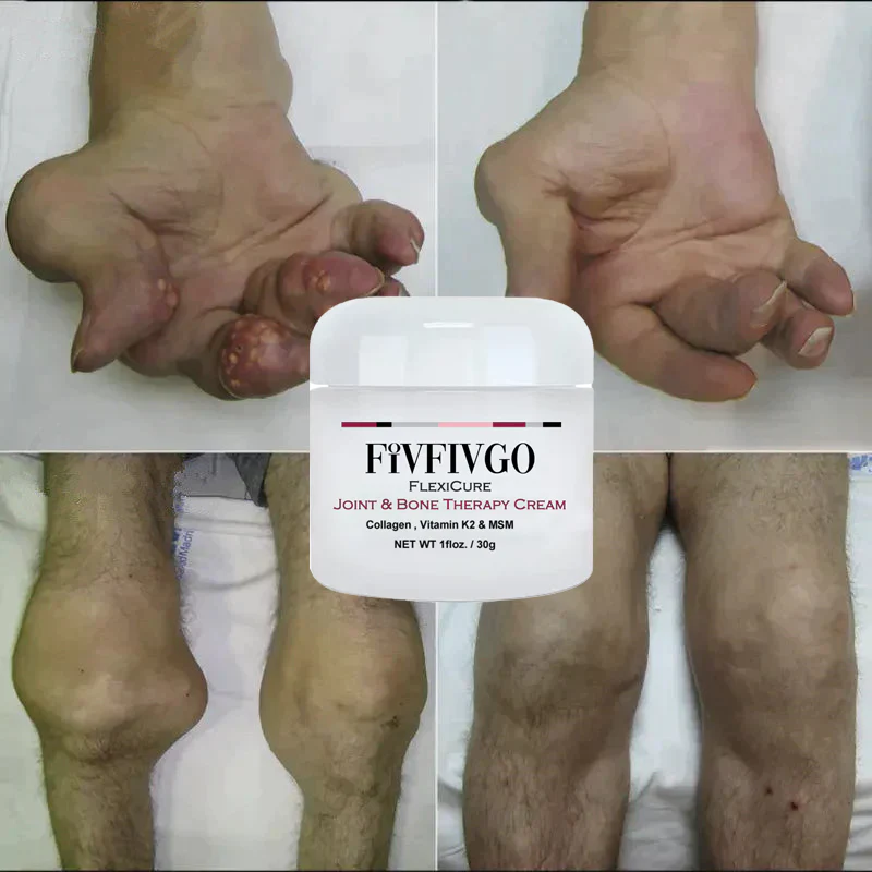 Fivfivgo FlexiCure Joint & Bone Therapy Cream