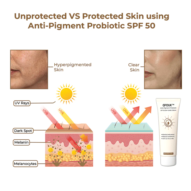 GFOUK Anti-Pigment Probiotic SPF 50 Day Care Cream