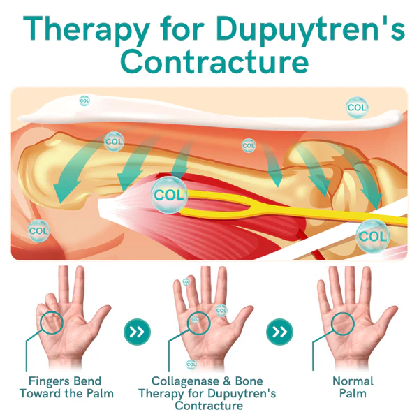 GFOUK Collagenase and Bone Therapy Cream