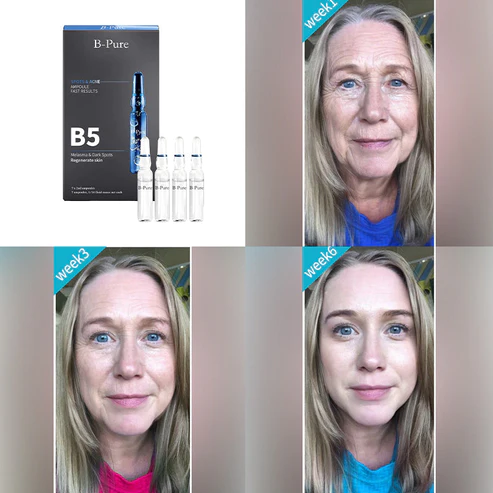 B-PureŽ Anti-Spot & Wrinkle Serum