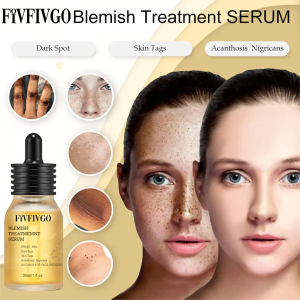 TLOPA Blemish Treatment serum for Dark Spots & Acanthosis Nigricans & Skin Tag