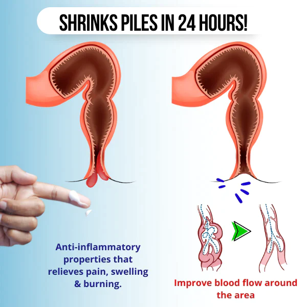 HemRelief Hemorrhoid & Fissure Cream