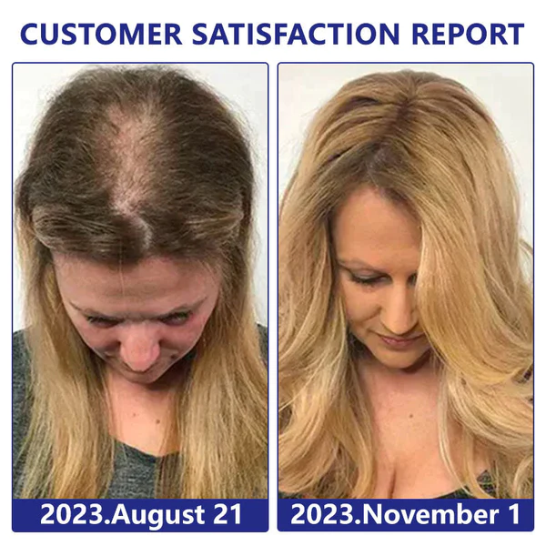 Furzero Follicle Repair Hair Regrowth Drops