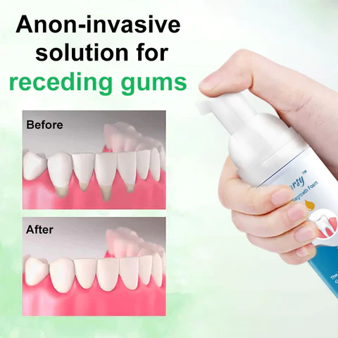 Daarsy Gums Regrowth Foam