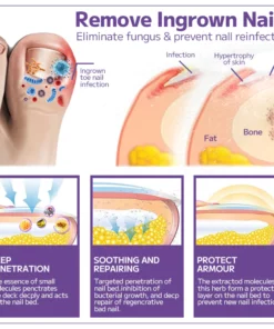 FurzeroAnti-fungal Nail Spray