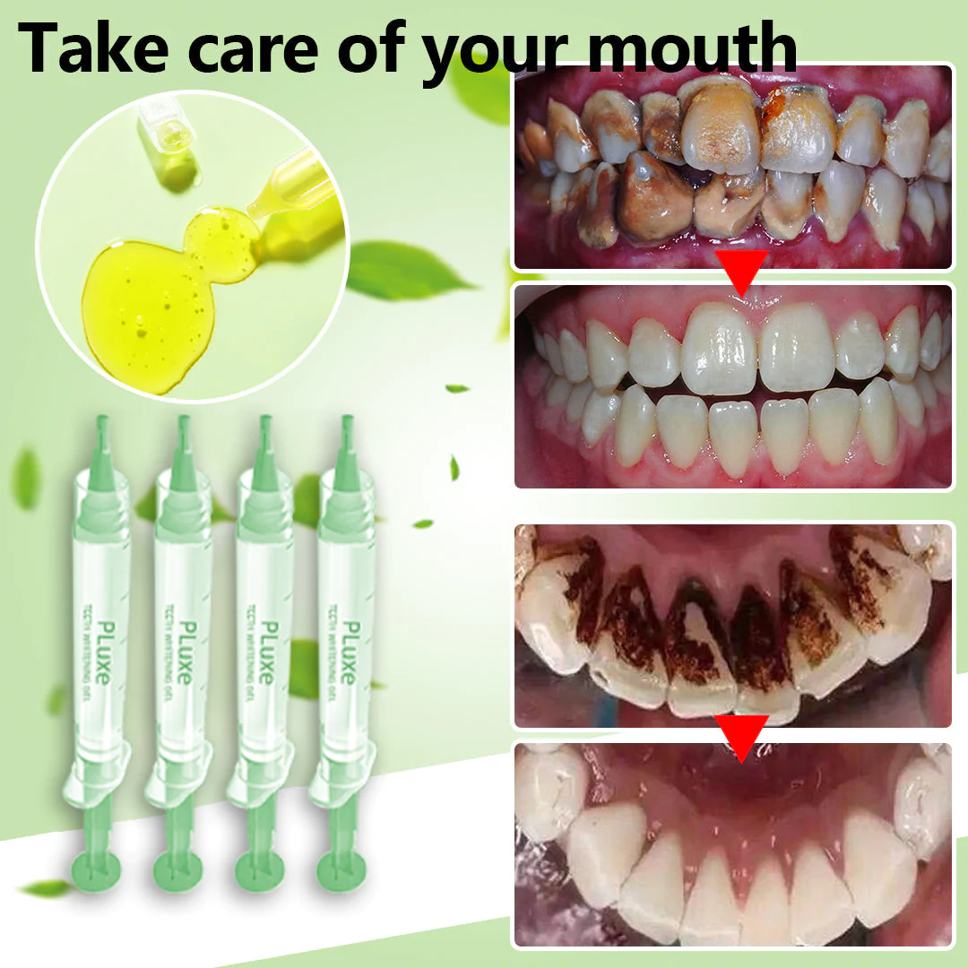 SharkŽ Teeth Whitening Gel