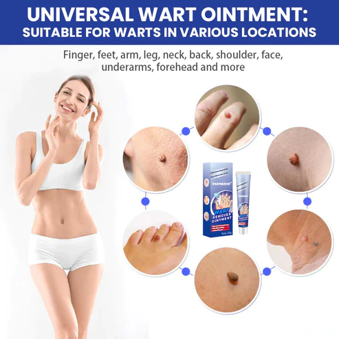 DermaEnd Wart Remover Herbal Ointment 100% Natural