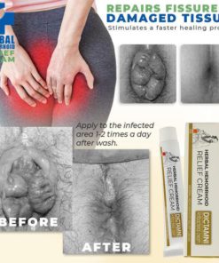 Hemorelief Hemorrhoids Treatment Ointment