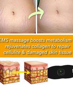 SmartFitness Fat & Cellulite Reduction EMS Belt