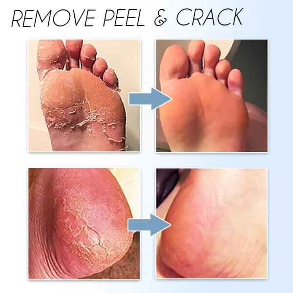 Premium Foot Peel Mask 2PCS