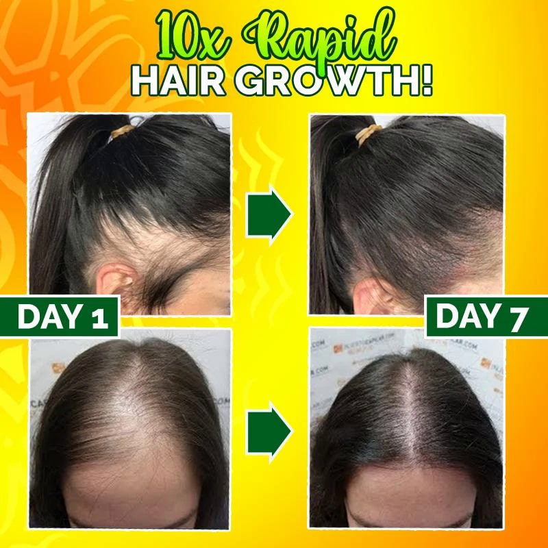 10X-Regro Strong Hair Serum