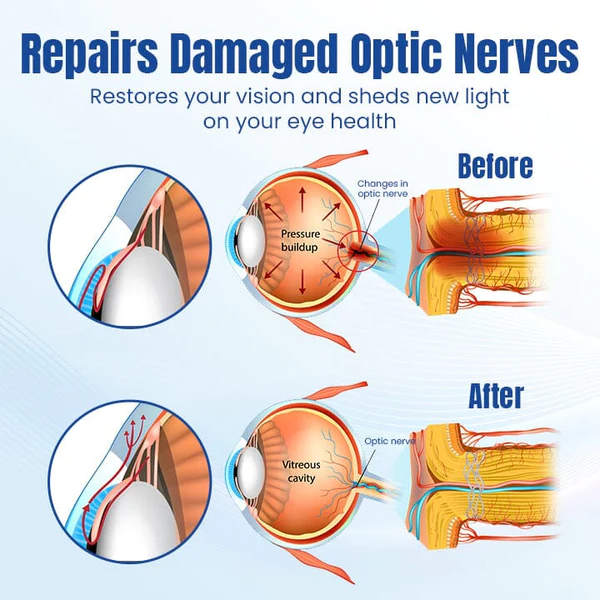 Ceoerty OptiRenew Eye Treatment Drops