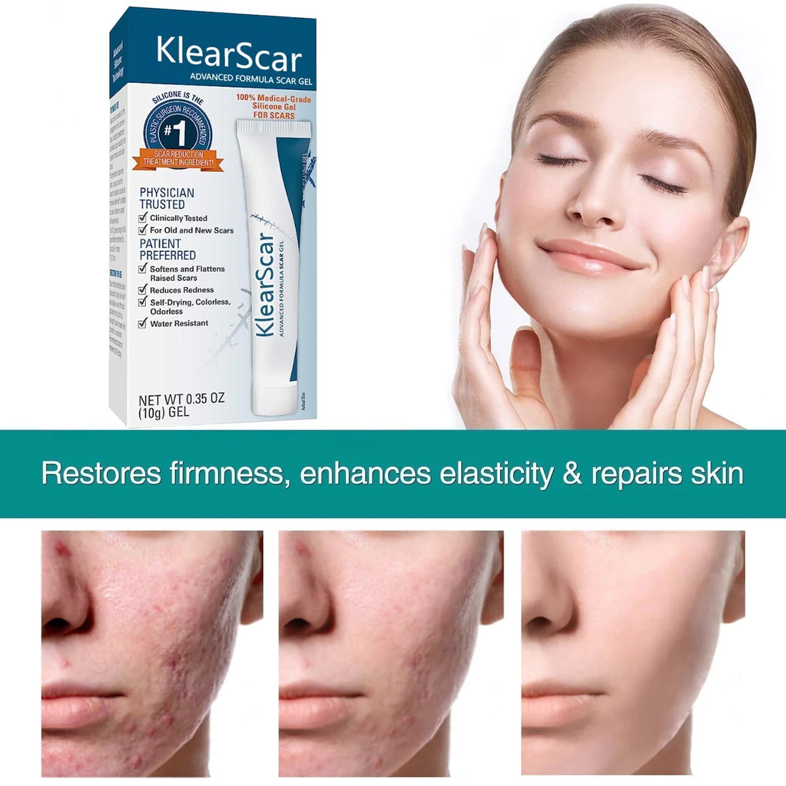 KlearScar Advanced Scar Removal Gel