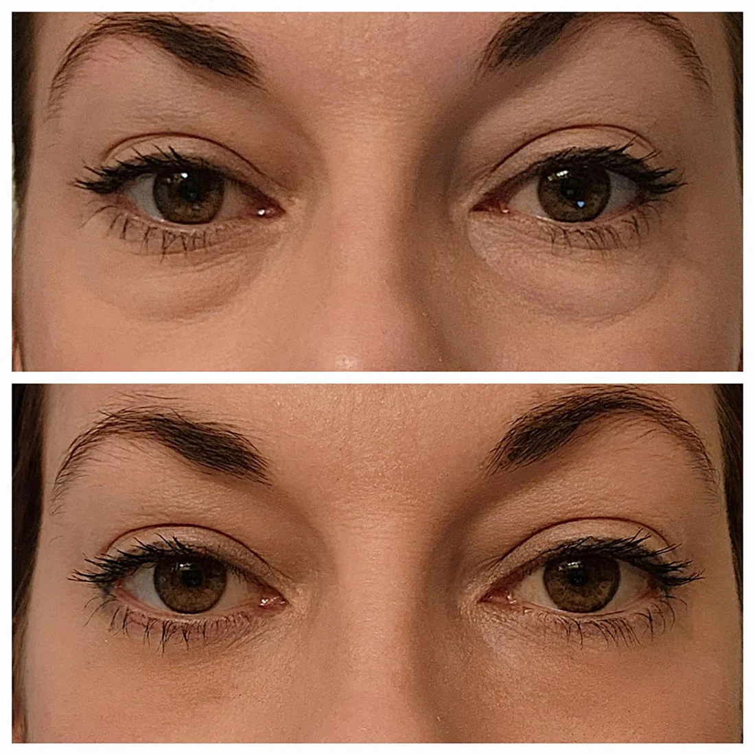 PuffLess Temporary Eye Tightener