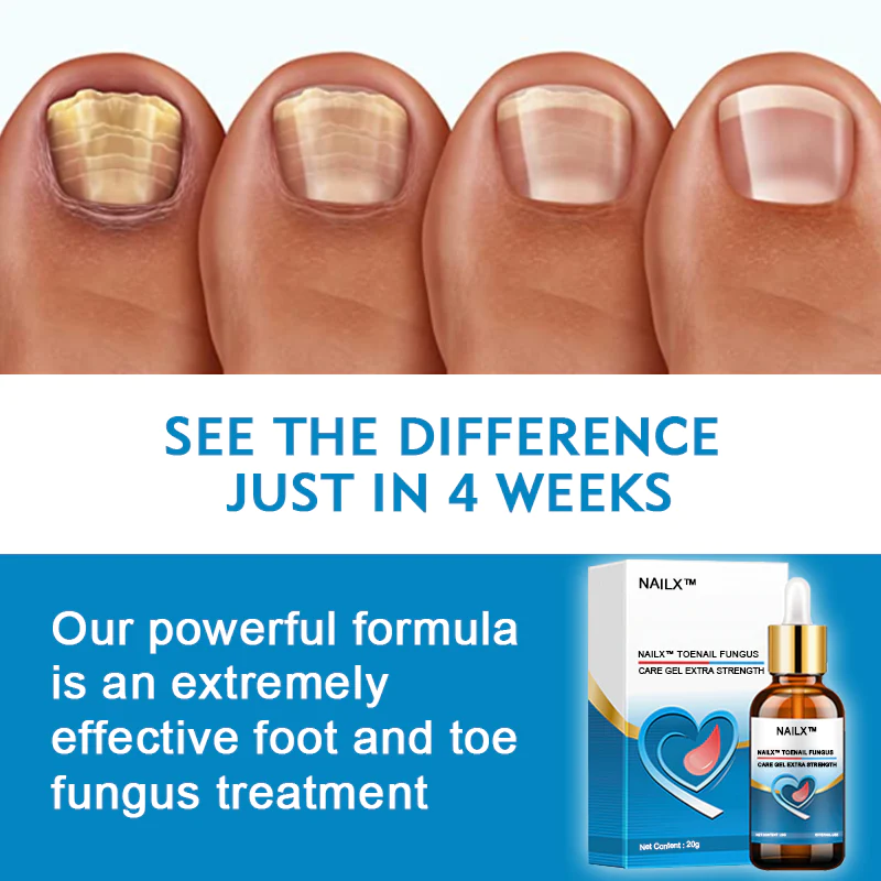 NailX Toenail Fungus Care Gel Extra Strength